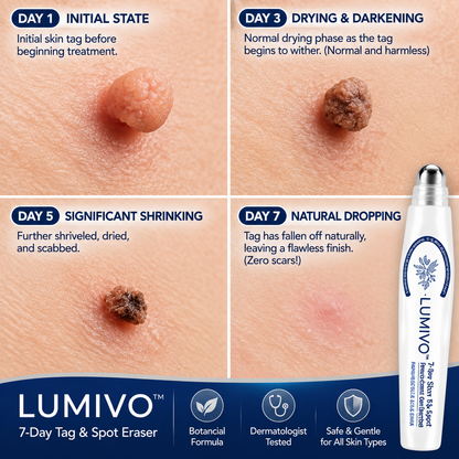 LUMIVO™👩‍⚕️ 𝟕-𝐃𝒂𝘆 𝐒𝗸𝐢𝐧 𝐓𝒂𝗴 & 𝐒𝐩𝙤𝐭 𝐄𝐫𝒂𝐬𝙚𝐫 Painless & Scar-Free Advanced Imperfection Removal Rollerball Pen